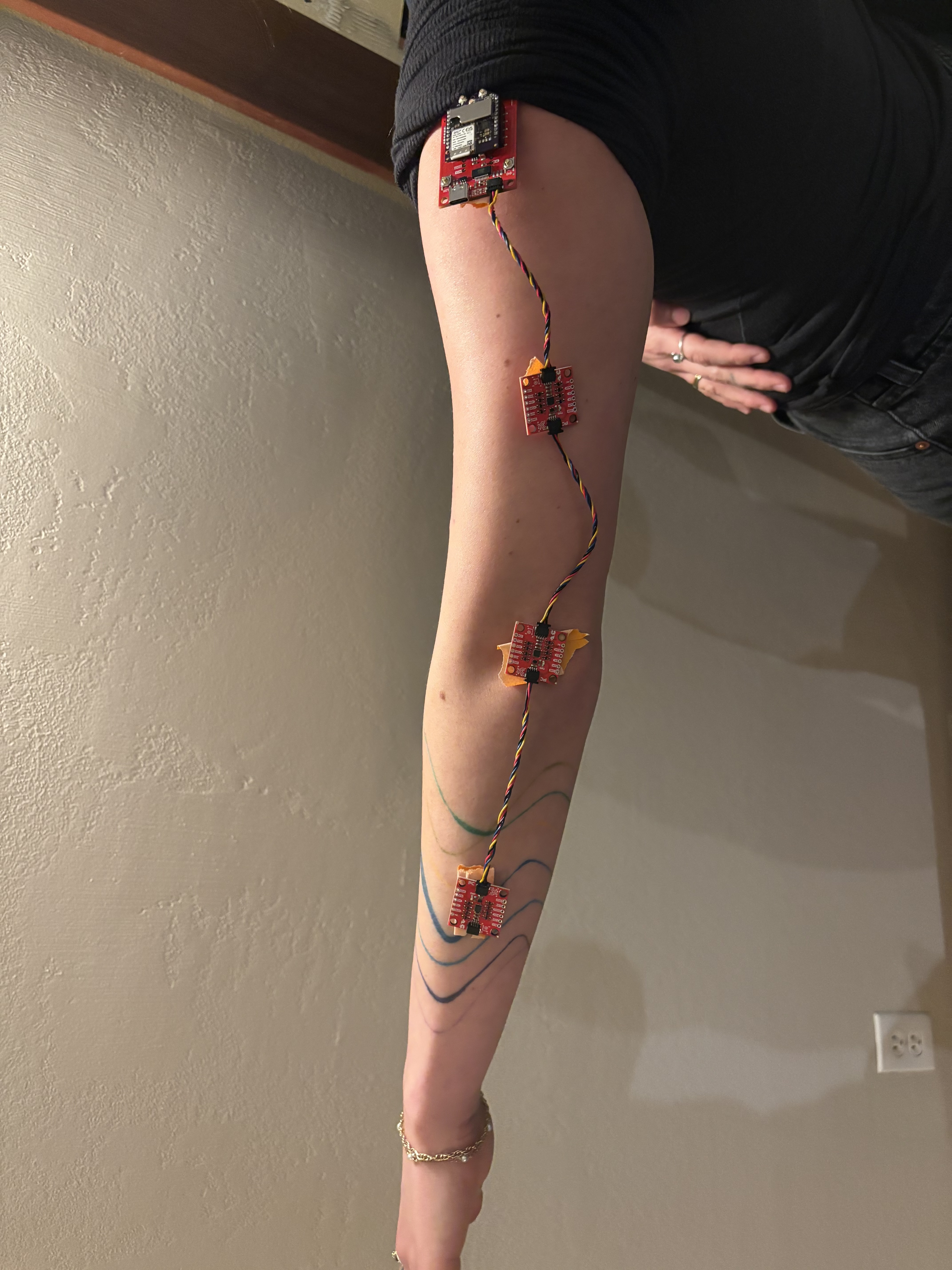 Scaleable Orthopedics Monitoring Hardware Device